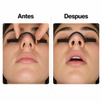 Dilatador Nasal Magnético ZENNT