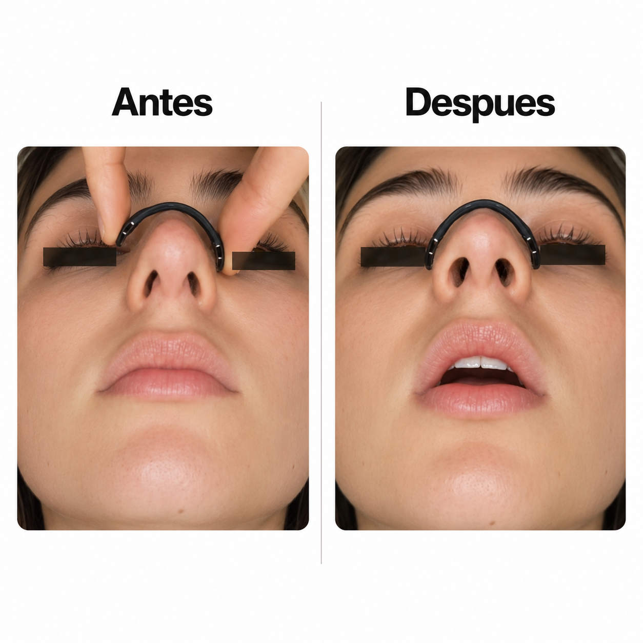 Dilatador Nasal Magnético ZENNT